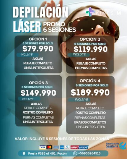 Depilación Laser